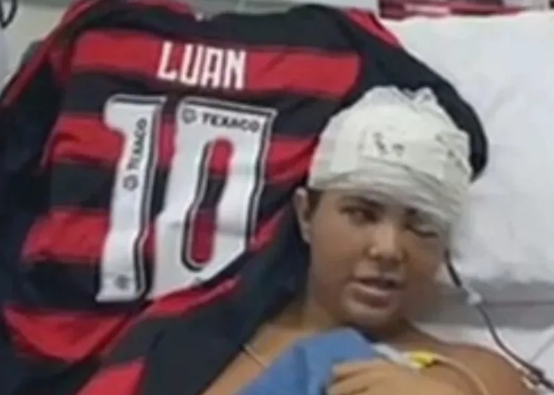 Palito de Churrasco no Crânio: Adolescente de 14 Anos Sobrevive Após Agressão Violenta em Ônibus na Avenida Brasil