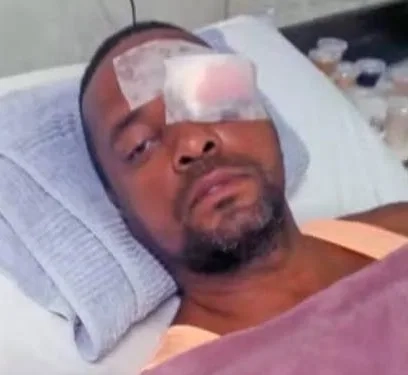 Tampa solta de bueiro faz táxi “voar”, motorista perde a visão e família cobra respostas