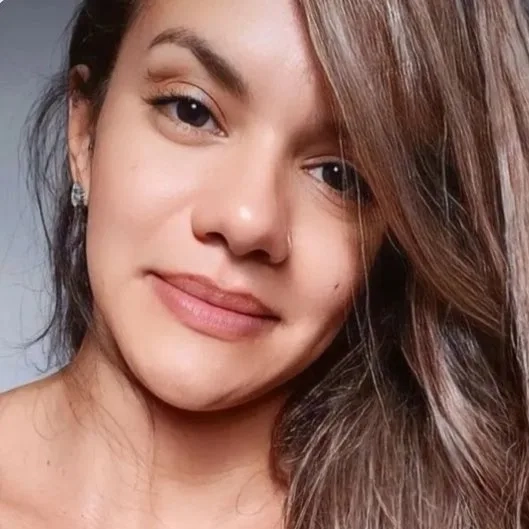 Após mais de 60 socos no rosto, Juliana passa por cirurgia de 9 horas para reconstrução facial: quadro ainda é grave