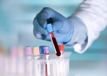 Revolução na Medicina: Japão Inicia Testes com Sangue Artificial Universal Feito de Bolsas Vencidas