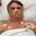 Carlos Bolsonaro levanta suspeita de que Jair Bolsonaro pode estar com câncer