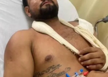 Ex miliciano tem o corpo fechado!! E escapa da morte 3 vezes em menos de 24h na Zona Oeste!!