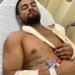 Ex miliciano tem o corpo fechado!! E escapa da morte 3 vezes em menos de 24h na Zona Oeste!!