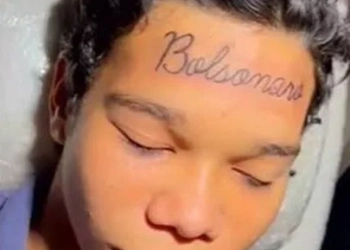 Do Fanatismo ao Arrependimento: Jovem com ‘Bolsonaro’ Tatuado na Testa Quer se Livrar da Marca