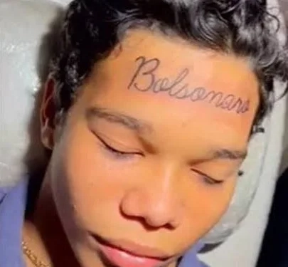 Do Fanatismo ao Arrependimento: Jovem com ‘Bolsonaro’ Tatuado na Testa Quer se Livrar da Marca