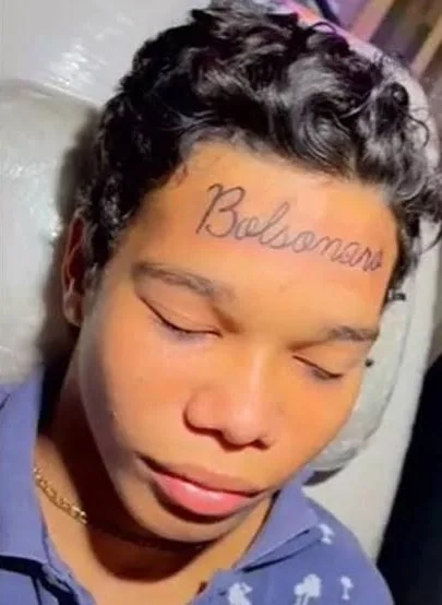 Do Fanatismo ao Arrependimento: Jovem com ‘Bolsonaro’ Tatuado na Testa Quer se Livrar da Marca