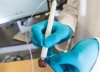 Caneta desenvolvida por brasileira detecta câncer em apenas 90 segundos