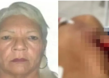 Mulher Esfaqueia Marido no Pescoço Após Ele Recusar Relação Sexual em um local inusitado