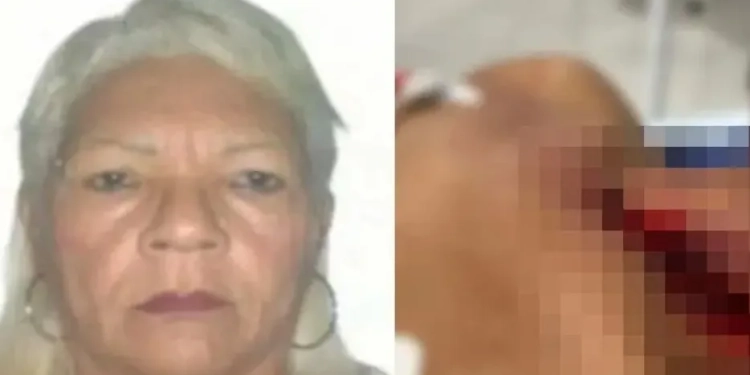 Mulher Esfaqueia Marido no Pescoço Após Ele Recusar Relação Sexual em um local inusitado
