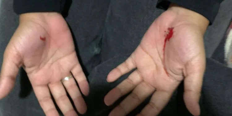 TERROR NA NOITE EM CAMPO GRANDE: ( FOTOS)  MULHER É AGREDIDA SEM MOTIVO APARENTE E FAZ ALERTA À POPULAÇÃO