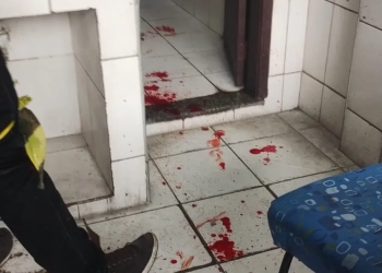 ( FOTOS) GRANADA DETONA APÓS MOTORISTA CONFUNDIR ARTEFATO COM BRINQUEDO NO RIO