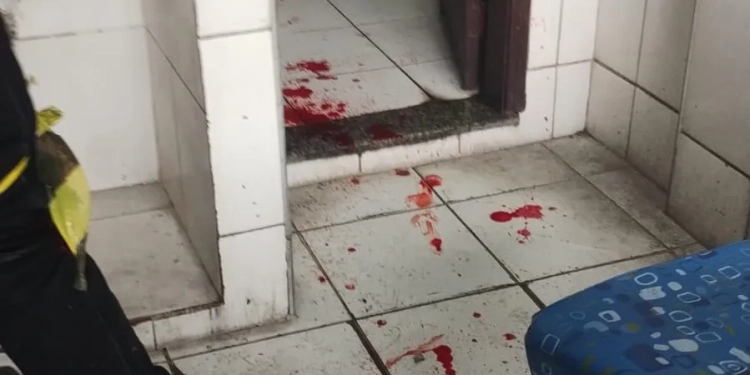 ( FOTOS) GRANADA DETONA APÓS MOTORISTA CONFUNDIR ARTEFATO COM BRINQUEDO NO RIO