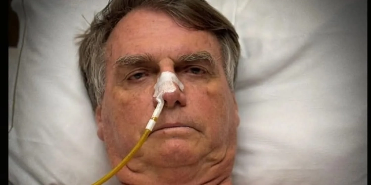 Estado de saúde de Bolsonaro preocupa médicos: ex-presidente está na UTI com quadro considerado grave