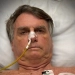 Estado de saúde de Bolsonaro preocupa médicos: ex-presidente está na UTI com quadro considerado grave