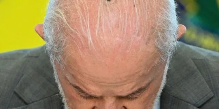 Lula inicia tratamento contra câncer de pele e fará 15 sessões de radioterapia preventiva