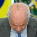 Lula inicia tratamento contra câncer de pele e fará 15 sessões de radioterapia preventiva