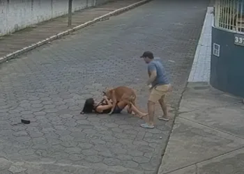 ( IMAGENS FORTES) ATAQUE DE PITBULL DEIXA JOVEM EM ESTADO GRAVE