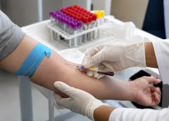 Última chance! Ação oferece exames de sangue gratuitos em Campo Grande e reforça prevenção à saúde