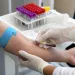 Última chance! Ação oferece exames de sangue gratuitos em Campo Grande e reforça prevenção à saúde