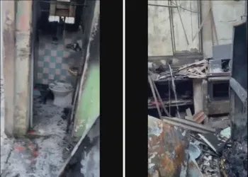 PAI TEM 70% DO CORPO QUEIMADO AO SALVAR A FILHA DE INCÊNDIO NA ZONA OESTE DO RIO
