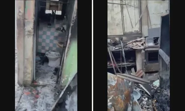 PAI TEM 70% DO CORPO QUEIMADO AO SALVAR A FILHA DE INCÊNDIO NA ZONA OESTE DO RIO