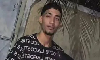 MOTOCICLISTA BALEADO NA CABEÇA LUTA PELA VIDA NO RIO; POLICIAL É PRESO APÓS DISPARO