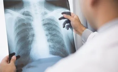 Médico analisa uma radiografia. Os sintomas do paciente, identificados na radiografia, e os resultados são relatados online por meio de videoconferência. Foto: Chanakon/AdobeStock