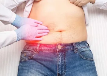 Pedra na vesícula e sinais que podem exigir avaliação médica.